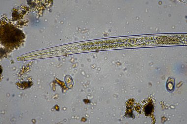 mikroorganizmalar ve toprak biyolojisi, mikroskop altında nematodlar ve mantarlar. Toprakta ve gübre örneğinde