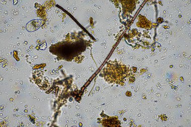 Topraktaki toprak ve gübre örnekleri, mantar ve mantarlar ve rejeneratif tarımda mikroskop altında bulunan toprak mikropları. Avusturalya 'da.