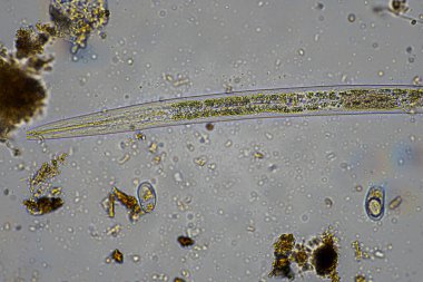 mikroorganizmalar ve toprak biyolojisi, mikroskop altında nematodlar ve mantarlar. Toprakta ve gübre örneğinde