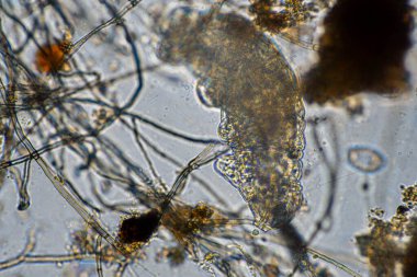 Topraktaki toprak ve gübre örnekleri, mantar ve mantarlar ve rejeneratif tarımda mikroskop altında bulunan toprak mikropları. Avusturalya 'da.