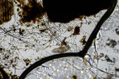 mikroorganizmalar ve toprak biyolojisi, mikroskop altında nematodlar ve mantarlar. Toprakta ve gübre örneğinde