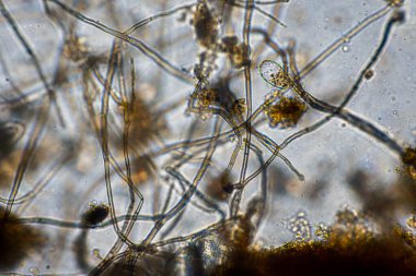 mikroorganizmalar ve toprak biyolojisi, mikroskop altında nematodlar ve mantarlar. Toprakta ve gübre örneğinde