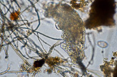 Topraktaki toprak ve gübre örnekleri, mantar ve mantarlar ve rejeneratif tarımda mikroskop altında bulunan toprak mikropları. Avusturalya 'da.