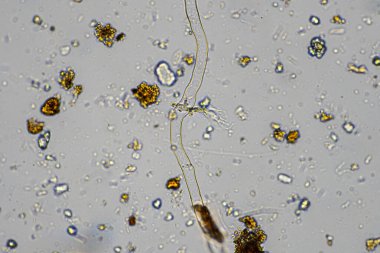 mikroorganizmalar ve toprak biyolojisi, mikroskop altında nematodlar ve mantarlar. Toprakta ve gübre örneğinde