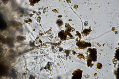 Topraktaki toprak ve gübre örnekleri, mantar ve mantarlar ve rejeneratif tarımda mikroskop altında bulunan toprak mikropları. Avusturalya 'da.