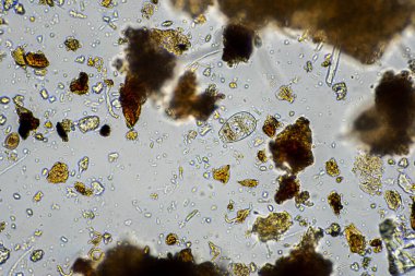 Topraktaki toprak ve gübre örnekleri, mantar ve mantarlar ve rejeneratif tarımda mikroskop altında bulunan toprak mikropları. Avusturalya 'da.