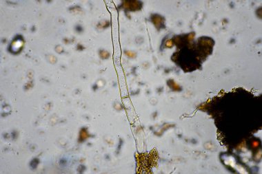 Topraktaki toprak ve gübre örnekleri, mantar ve mantarlar ve rejeneratif tarımda mikroskop altında bulunan toprak mikropları. Avusturalya 'da.