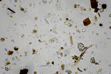 Topraktaki toprak ve gübre örnekleri, mantar ve mantarlar ve rejeneratif tarımda mikroskop altında bulunan toprak mikropları. Avusturalya 'da.