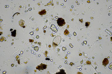 mikroorganizmalar ve toprak biyolojisi, mikroskop altında nematodlar ve mantarlar. Toprakta ve gübre örneğinde
