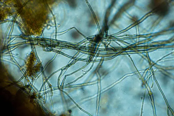 mikroorganizmalar ve toprak biyolojisi, mikroskop altında nematodlar ve mantarlar. Toprakta ve gübre örneğinde