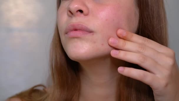 Deri Kusurları Için Aynaya Bakan Genç Bir Kızın Dudakları Burnu — Stok video