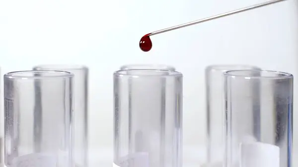 Doctor laboratory technician using needle fill blood test tubes. High quality photo