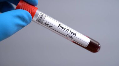 Mikrobiyolog ya da sağlık görevlisi kan testi için el ele tutuşur. Yüksek kalite fotoğraf