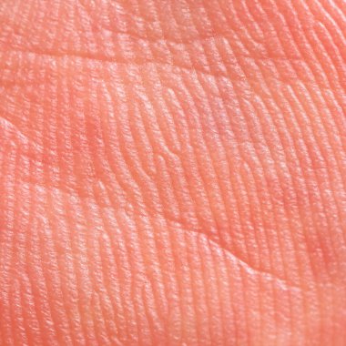 It is Hand skin texture.