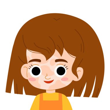Cartoon portrait of a smiling girl with vitiligo spots on her face. Flat kawaii vector illustration isolated on white background. Cute image for picture books, posters or inclusive learning projects