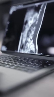 Bir tıp fakültesi öğrencisinin laptop ekranı, online öğrenme. Yüksek kalite 4k görüntü