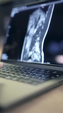 Tıp fakültesi öğrencileri dizüstü bilgisayar, online eğitim. Yüksek kalite 4k görüntü