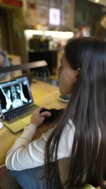 Atrakcyjny Student Uniwersytetu Medycznego Słucha Wykładu Kawiarni Przed Laptopem Wysokiej — Wideo stockowe