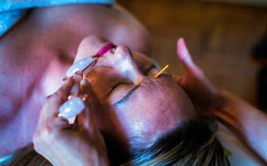 Yüzünde akupunktur tedavisi gören bir kadın. Yeşim yüz masajı aleti kullanıyor. Kozmetik işlemler için bir madde.