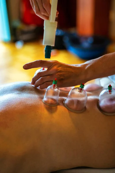 Usage of acupuncture points in a modern clinic. Woman receiving cupping treatment on back by therapist, chinese medicine treatment, health and healing concept.