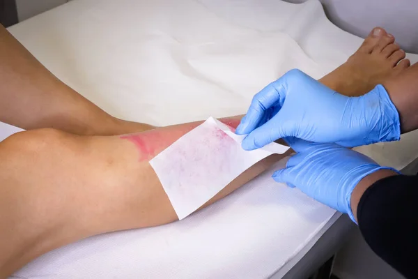 Hair removal procedure on leg with wax depilatory in salon,beautician applying pink depilatory wax to a young woman\'s leg for hair removal.Strip of material over the wax to remove the hairs,close up