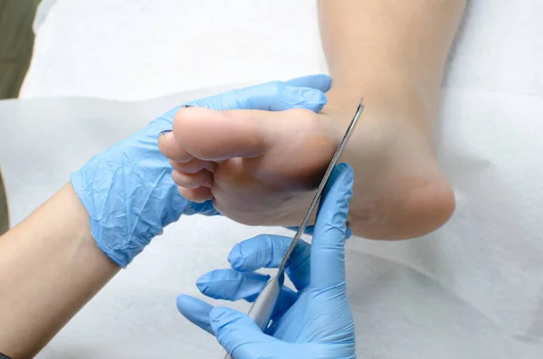 美容室でプロの医療用ペディキュア手順を行う青い手袋の小児科医 足の治療のための特別なグレーターでかかとをこすりクローズアップ — ストック写真
