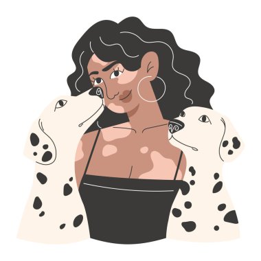 Vitiligo 'lu genç kadın portresi ve iki dalmaçyalı. Çeşitlilik ve evcil hayvan sevgisi. Beyaz arkaplanda düz vektör illüstrasyonu.
