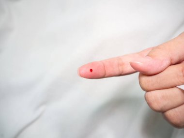 Diyabet testi. Sağlık ve tıbbi konsept diyabetik kandaki glikoz seviyesini ölçer..