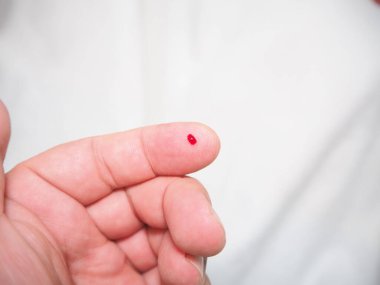 Diyabet testi. Sağlık ve tıbbi konsept diyabetik kandaki glikoz seviyesini ölçer..