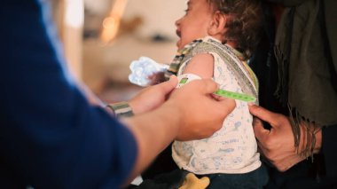 Bir doktor mülteci kampında çocukların yetersiz beslenmesini inceliyor. Yetersiz beslenme orta-üst kol çevresi kemeri kullanılarak ölçüldü.