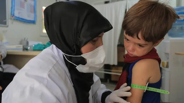 Bir doktor mülteci kampında çocukların yetersiz beslenmesini inceliyor. Yetersiz beslenme orta-üst kol çevresi kemeri kullanılarak ölçüldü.