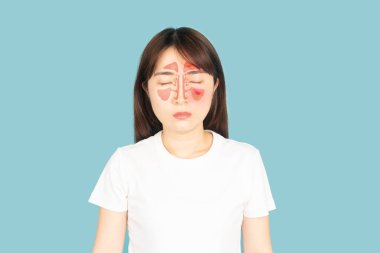 Mavi arka planda burun sinüsleri olan Asyalı kadın yüzü. Burun tıkanıklığı olan sağlıklı sinüs ve sinüzit..