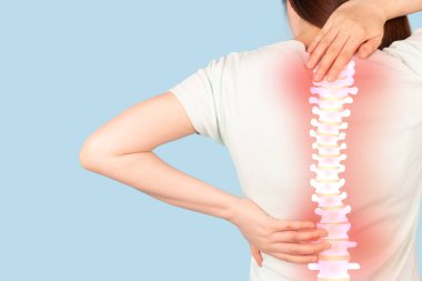 Omurga anatomisi ve röntgenden muzdarip bir kadın teşhis için mavi arka planda. Yaygın sebepler arasında kas ağrısı iltihabı veya omurilik stenozu gibi yaralanmalar yer alıyor..