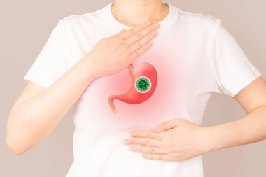 Mide ekşimesi ve karın ağrısı çeken bir kadın. Helicobacter pillori bakterisi insan midesine bulaşır. H.pylori enfeksiyonları mide iltihabı (gastrit) ve peptik ülser hastalıklarına neden olabilir..