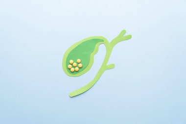 Safra kesesi taşı (kolelithiasis) anatomisi mavi arka plandaki kağıttan yapılır. Safra taşı safra kesesi sistemindeki safra akışını engeller. Kolesistite, pankreas iltihabı, kolanjit....