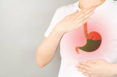 Gastroözofagus reflü hastalığı (GERD) veya asit reflü semptomları. Mide ekşimesi, karın ağrısı, bulantı ve şişkinlik çeken bir kadın. Gastrointestinal sistem hastalığı ve sindirim sorunları.
