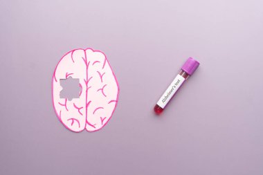 Beyin, yapbozun bir parçasını ve mor arka planda Alzheimer test etiketli kan örneği tüpünü kaybetmiş. Alzheimer hastalığının erken belirtilerini tespit etmeye yardımcı olabilecek bir kan testi..