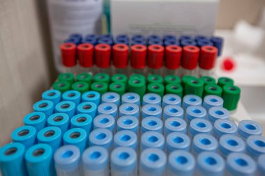 Laboratuvar arka planında analiz makineleri olan bir raftan kan örneği tüpü. Laboratuvar santrifüj makinesinde hazırlanmış kan tüpleri..