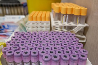 Laboratuvar arka planında analiz makineleri olan bir raftan kan örneği tüpü. Laboratuvar santrifüj makinesinde hazırlanmış kan tüpleri..