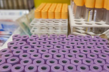 Laboratuvar arka planında analiz makineleri olan bir raftan kan örneği tüpü. Laboratuvar santrifüj makinesinde hazırlanmış kan tüpleri..