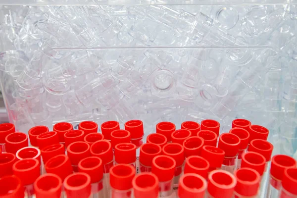 Blood sample tube from a shelf with analysis machines in the laboratory background. tubes prepared in laboratory centrifuge machine blood bank.