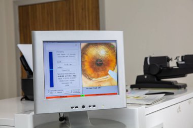 Laser vision correction.Patient and team of surgeons in the operating room during ophthalmic surgery. Eyelid speculum. Lasik treatment. Patient under blue sterile cover. Cataract lens replacement.