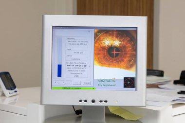 Göz cerrahi işlem, katarakt ve diyoptri düzeltme tedavisinde. Cerrahi uygulama multifokal lens implantları. Tıbbi sağlık ve teknoloji Tema.