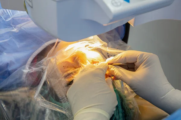 Laser vision correction.Patient and team of surgeons in the operating room during ophthalmic surgery. Eyelid speculum. Lasik treatment. Patient under blue sterile cover. Cataract lens replacement.