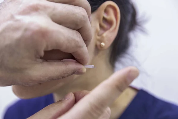 Dry needle treatment. A portrait of a small acupuncture needle sticking in a person\'s face next to the nose, to heal pain, relieve stress or another medical condition with alternative medicine.