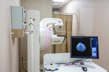 Hastanede mammografi testi. Tıbbi ekipman. Mammografi göğüs tarama cihazı hastane laboratuvarında. Sağlık, tıbbi teknoloji, yüksek teknoloji ekipman konsepti..