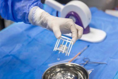 Hastanedeki hasta için kalp kapakçığı ameliyatı kardiyolojisi. Doktorun eline transkateter aort kapakçığı naklini hazırlayın..