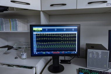 Denizli, Türkiye - 28 Şubat 2024; Hastanedeki ameliyathanede ameliyat sırasında hastanın hayati belirtileri ve ECG verileri ile monitör ekranı. Hasta kalp atış hızı ve kan basıncı.