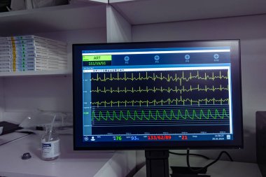 Denizli, Türkiye - 28 Şubat 2024; Hastanedeki ameliyathanede ameliyat sırasında hastanın hayati belirtileri ve ECG verileri ile monitör ekranı. Hasta kalp atış hızı ve kan basıncı.