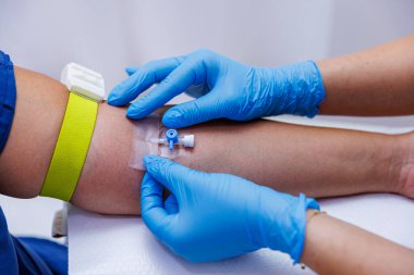 Hastanede verilen serumu olan bir hasta. Serum hastaya verilir. Hemşirenin hastasına yaptığı serum. Doktor hastaya damar yolu açarken....